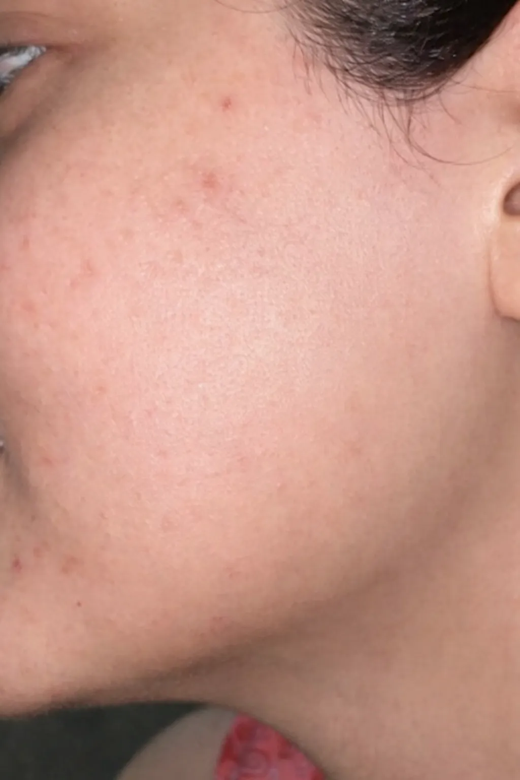 After Face Waxing Services At US Hairline Selon