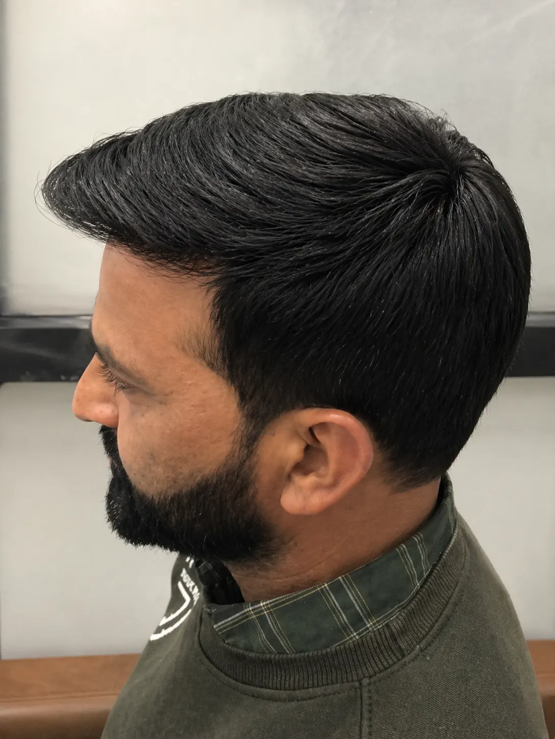 After Hair Patch for Men At US Hairline Salon
