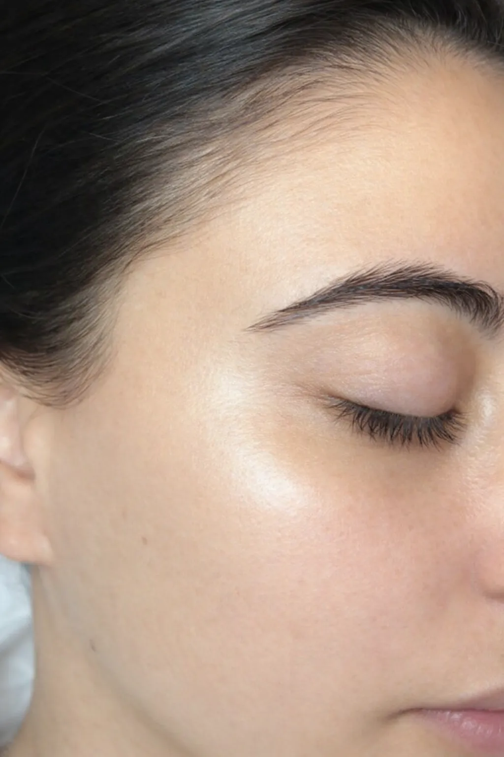 After Hair Remove At US hairline