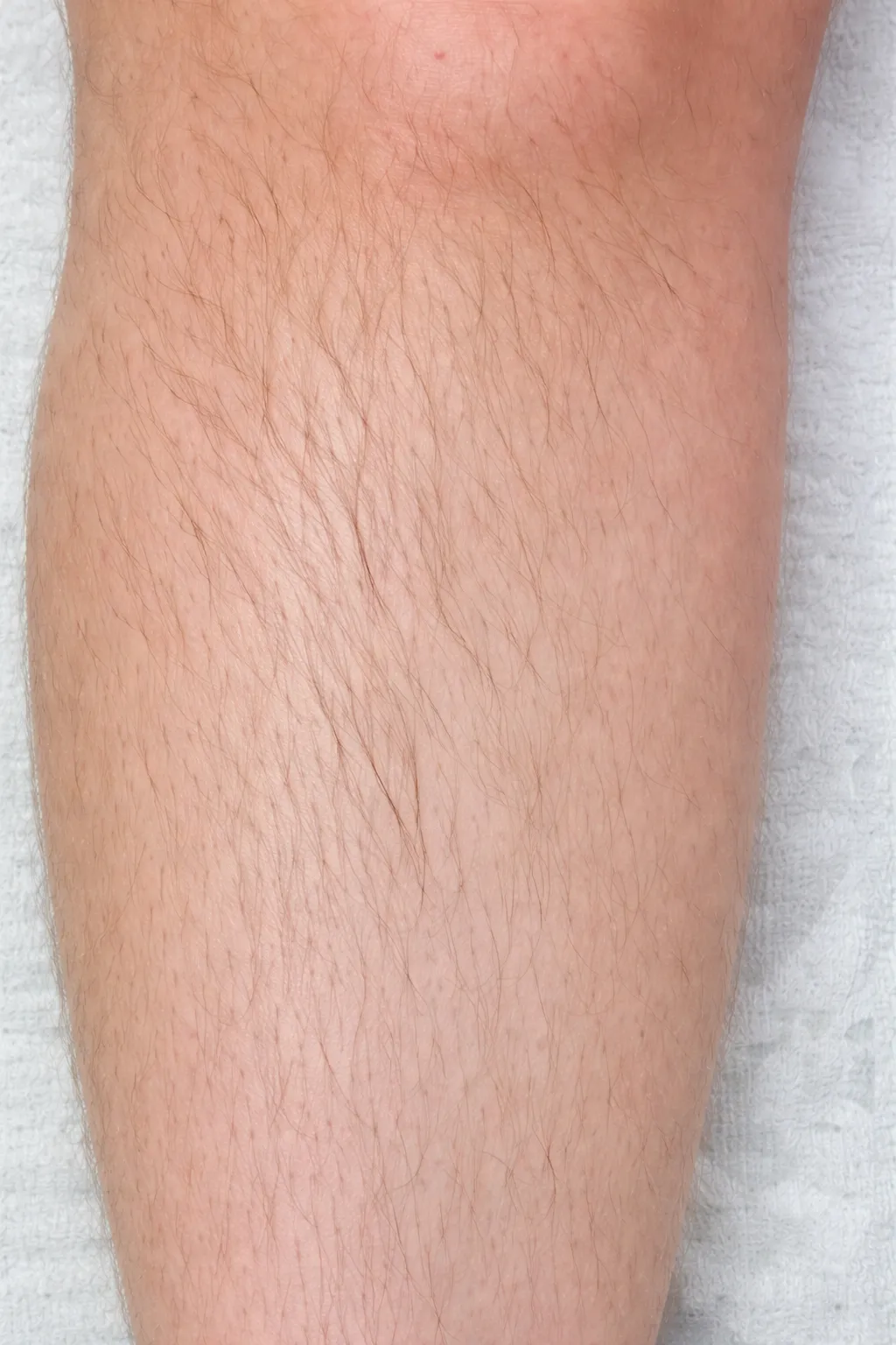 Before Body Waxing Services At US Hairline Selon
