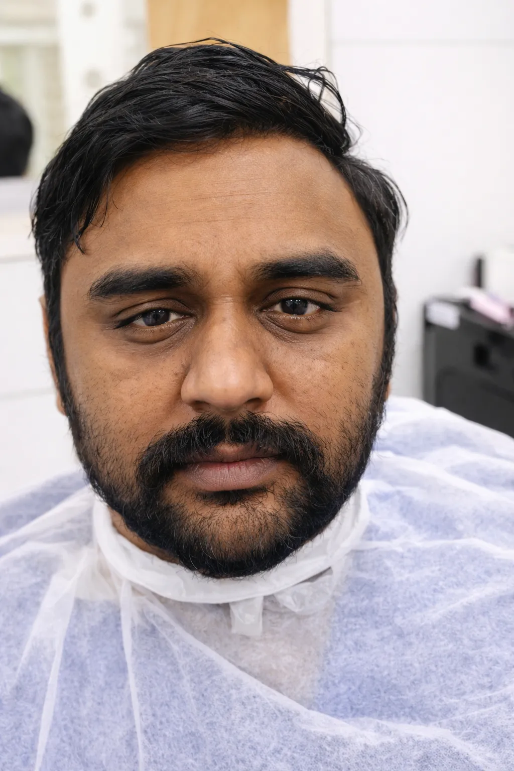 Before Clean Up At US Hairline Salon