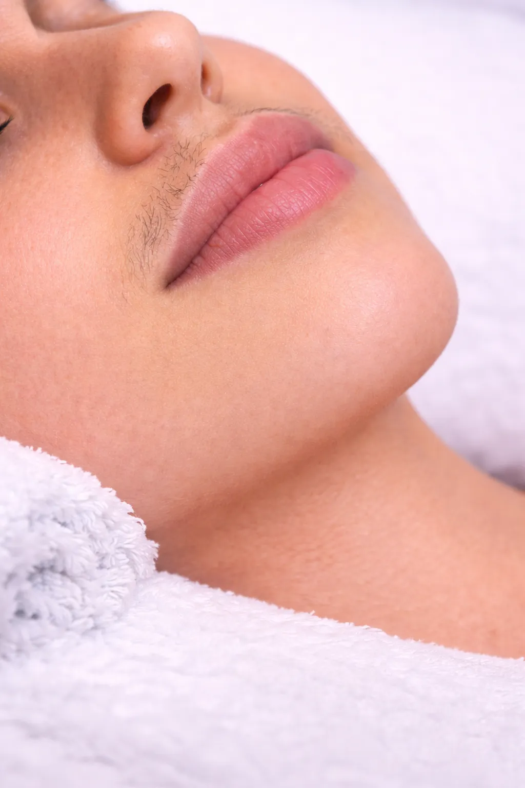 Before Face Waxing At US Hairline Salon