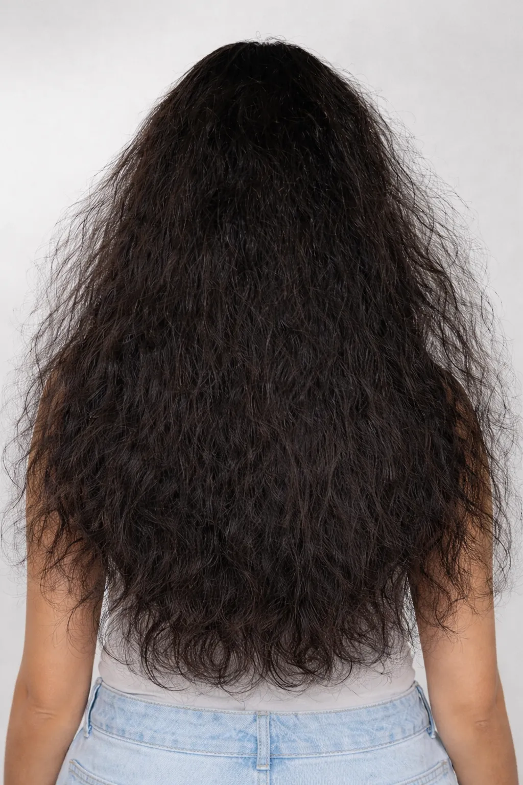 Before Hair At US hairline