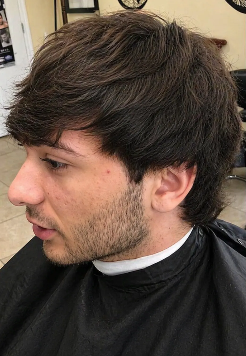 Before Hair Cut At US hairline Salon (2)