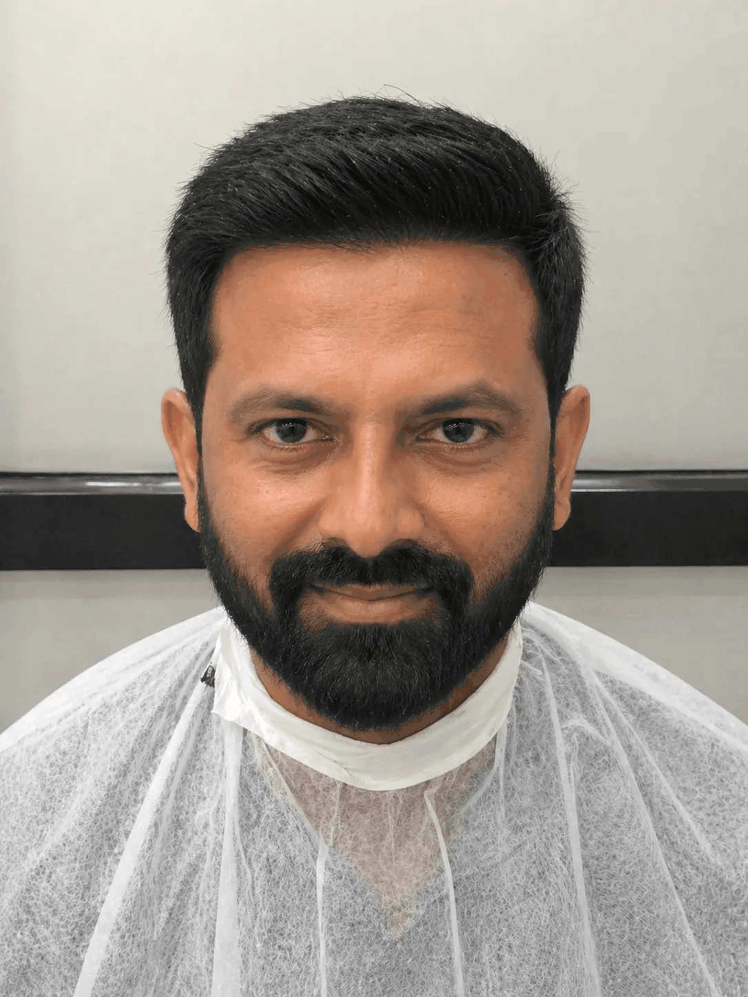 Best Hair Patch for Men in Ashok Nagar, Bangalore for Natural Hair Restoration At US Hairline Salon