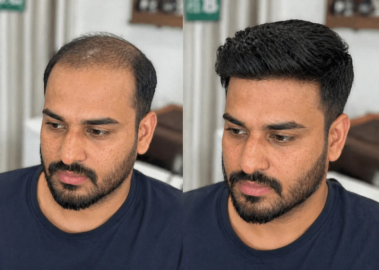 Hair Patch