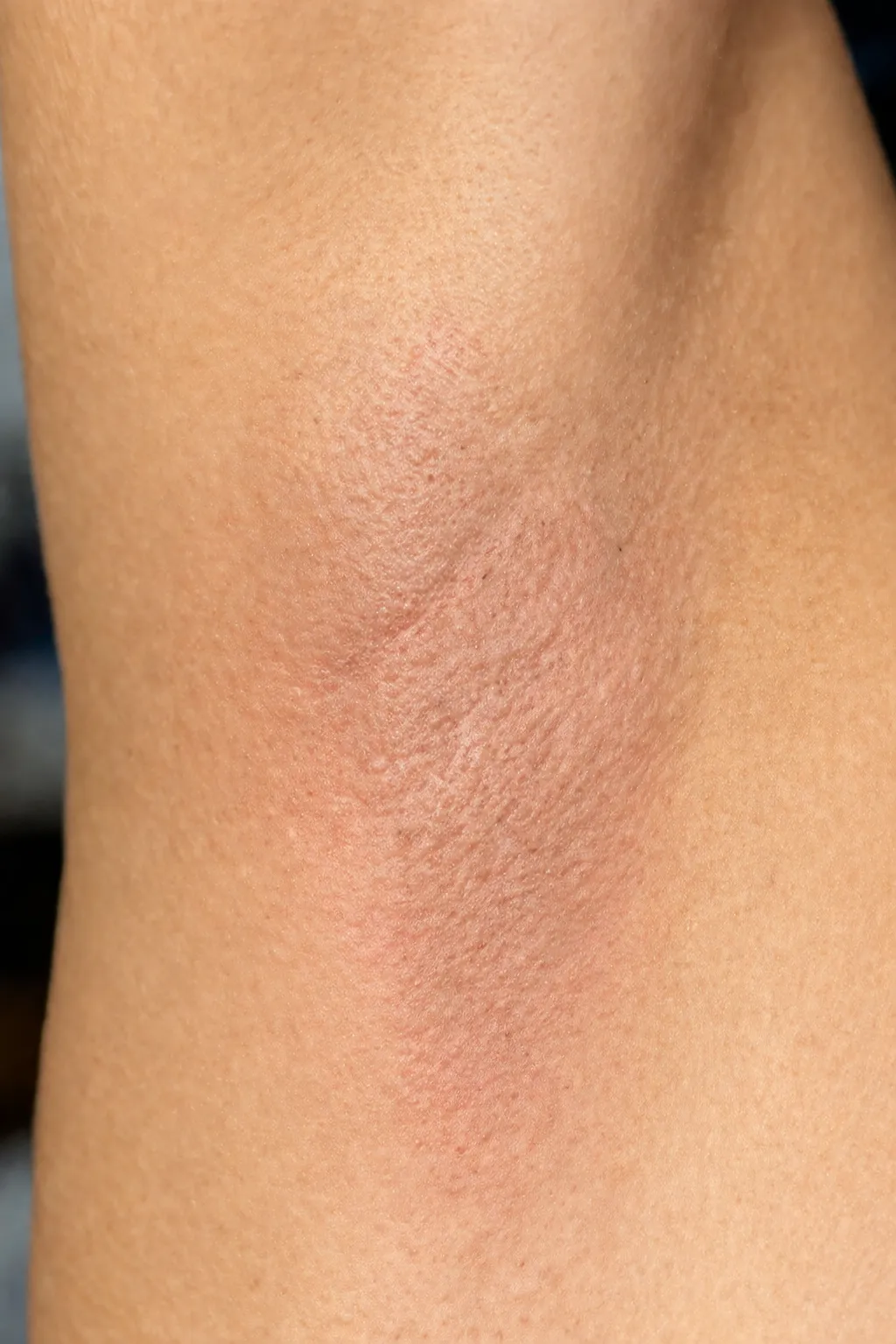 Honey Wax Hair Removal for Women After Transformation