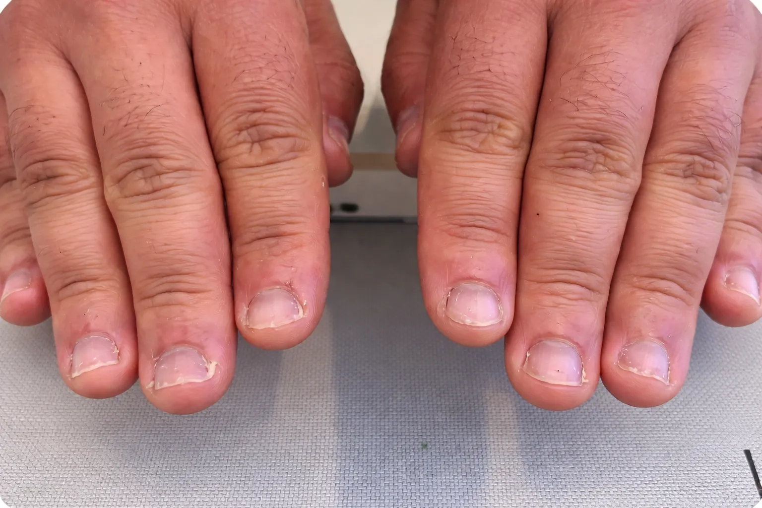 Manicure and Pedicure Services for Men Before Transformation At US Hairline Salon