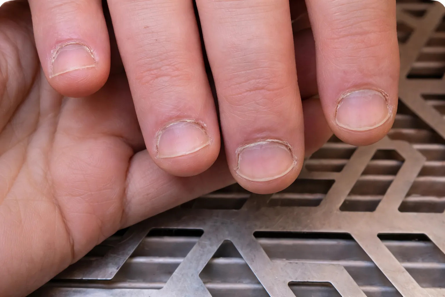 Manicure and Pedicure Services for Men Before Transformation At US Hairline Salon