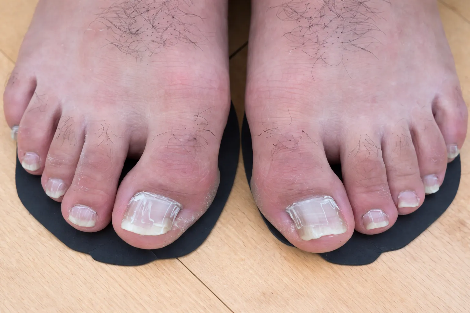 Manicure and Pedicure Services for Men Before and After Transformation At US Hairline Salon