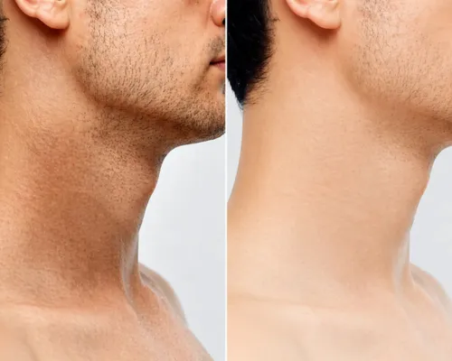  Face & Neck Detan